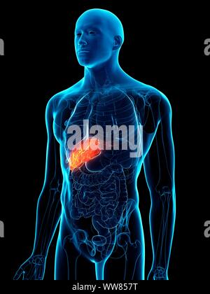 Diseased liver, conceptual illustration Stock Photo