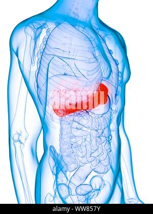 Diseased liver, conceptual illustration Stock Photo