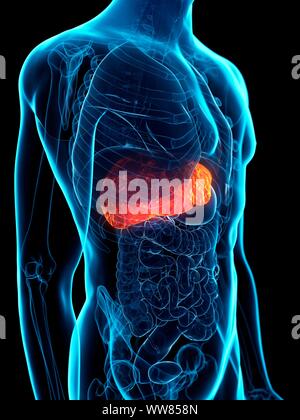 Diseased liver, conceptual illustration Stock Photo