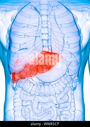 Diseased liver, conceptual illustration Stock Photo