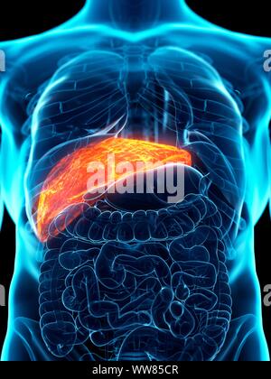 Diseased liver, conceptual illustration Stock Photo