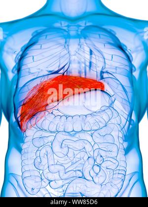 Diseased liver, conceptual illustration Stock Photo