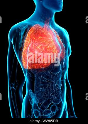 Diseased lung, conceptual illustration Stock Photo