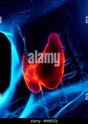 Diseased thyroid gland, conceptual illustration Stock Photo