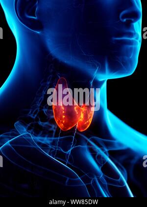 Diseased thyroid gland, conceptual illustration Stock Photo