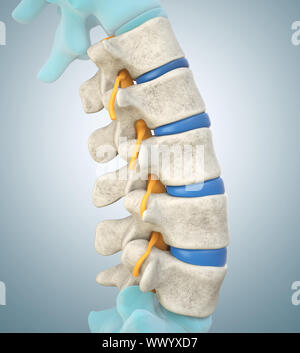 Human lumbar spine model demonstrating herniated disc, pressure nerve ...