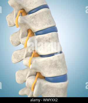 Human lumbar spine model demonstrating thinned disc. 3D illustration Stock Photo