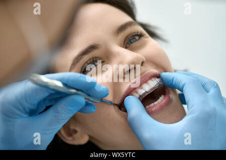 Glad girl in a dental clinic. Dentist in protective blue gloves with a dental mirror is putting on her teeth an impression tray base. Closeup horizont Stock Photo