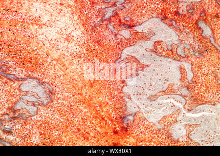 Heart fatty tissue under the microscope 200x Stock Photo