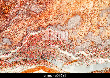 Heart fatty tissue under the microscope 200x Stock Photo