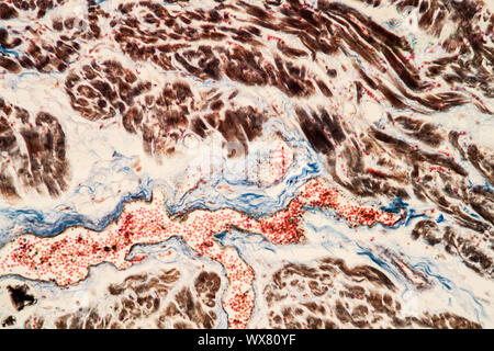 Heart fatty tissue under the microscope 200x Stock Photo