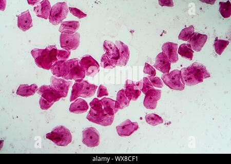 Epithelial cells with bacteria from the oral cavity 200x Stock Photo
