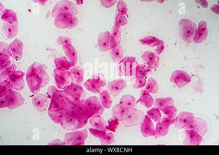 Epithelial cells with bacteria from the oral cavity 200x Stock Photo