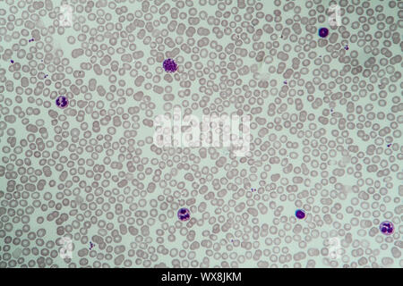 Red and white blood cells 400x Stock Photo