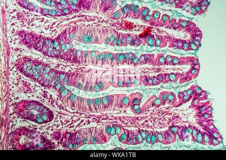 Small intestine with intestinal villi under the microscope 100x Stock ...