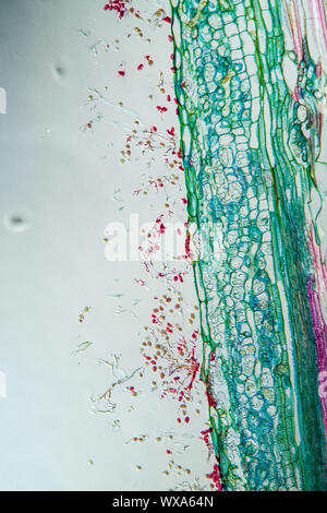 Fungal infection downy mildew on shepherd's purse 100x Stock Photo
