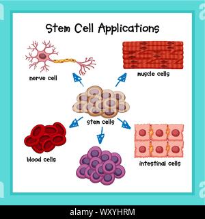 Illustration of the Human Stem Cell Applications on a white background ...