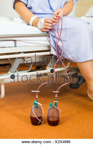 Drainage tubes after surgery Stock Photo: 91227067 - Alamy