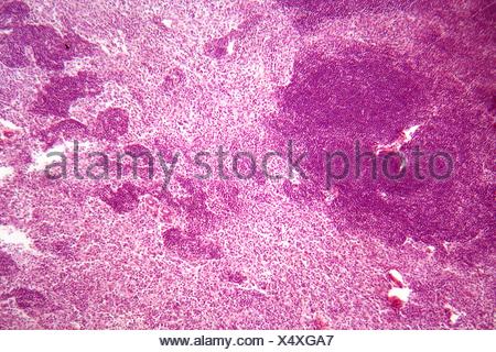 Lymph node under the microscope Stock Photo - Alamy