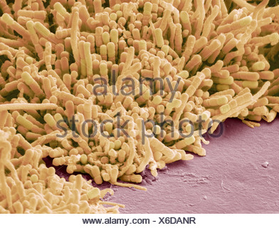 Plaque-forming bacteria, coloured scanningelectron micrograph (SEM ...