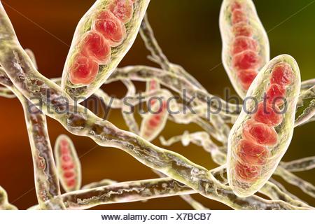 Computer illustration of Trichophyton mentagrophytes, the cause of ...