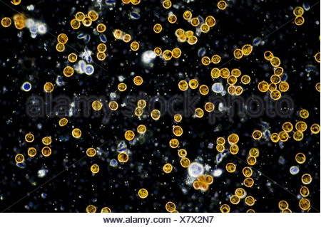 Microscopic photo of symbiotic algae (Zooxanthellae) of the Stock Photo ...