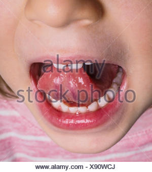 Little girl protruding tongue Stock Photo: 103535673 - Alamy