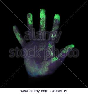 Ultraviolet light showing bacteria on a person's hand Stock Photo ...