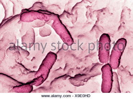 Scanning electron micrograph (SEM) of Pseudomonas aeruginosa Stock ...