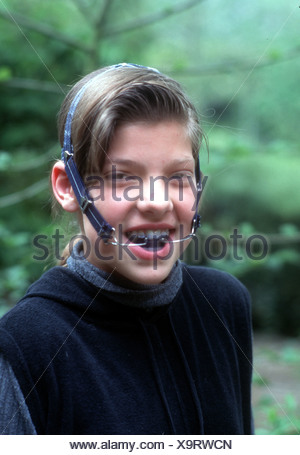 Western dental braces Western dental braces