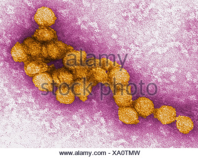 An electron micrograph West Nile virus. West Nile virus is flavivirus ...