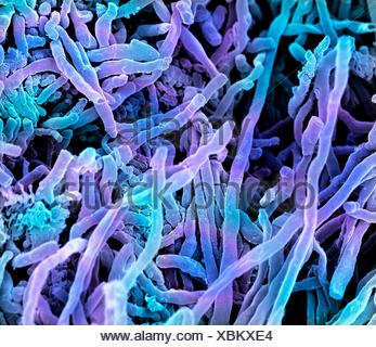 Streptomyces coelicoflavus bacteria. Coloured scanning electron Stock ...