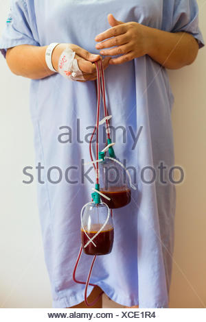 Drainage tubes after surgery Stock Photo: 91227067 - Alamy