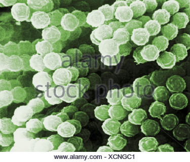 Scanning Electron Micrograph Aspergillus species Stock Photo: 56151972 ...