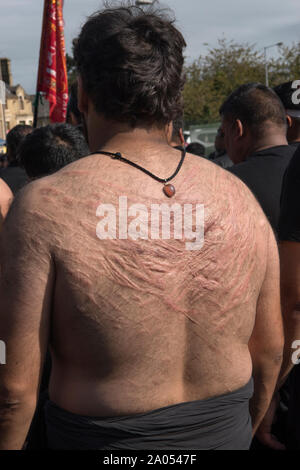 Selbst geißelung Narben von Schlägen mit Ketten und Schwerter, muslimischen Gemeinschaft Bradford 2019 2010 s UK. Tag der Ashura Parade der schiitischen Muslime erinnern das Martyrium von Shafiq Husayn ibn Ali. HOMER SYKES Stockfoto