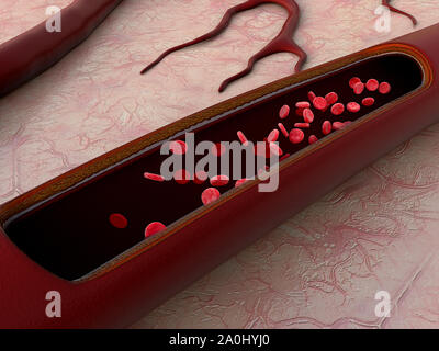 Arterie, Arterie mit einem abgetrennten Bereichs, hochwertige Rendering mit original Texturen und Global Illumination, Kontraktion der Blutgefäße dargestellt Stockfoto