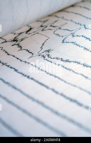 EEG-Kurve im menschlichen Gehirn, Gehirn Wellenmuster auf elektroenzephalogramm Probleme auf, die die elektrische Aktivität des Gehirns Stockfoto