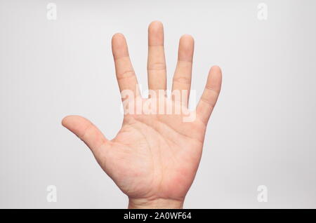 Hand palm Haut nach der Behandlung von Krankheiten. Stockfoto