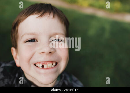 Porträt eines Jungen mit Sommersprossen und schiefe Zähne Stockfoto