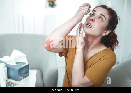 Frau mit Kratzspuren auf den Ellenbogen mit Augentropfen Stockfoto