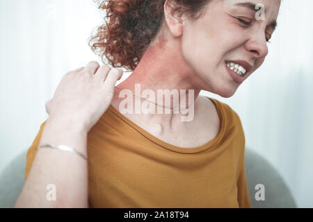 Frau mit orangefarbenen T-Shirt mit Hautausschlag und Rötung am Hals Stockfoto