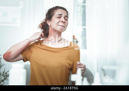 Frau mit Ausschlag auf den Hals und Arme wegen einer Allergie. Stockfoto