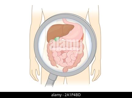 Menschliche Verdauungssystem mit Lupe diagnostizieren. Stock Vektor