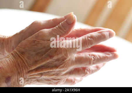 Eine ältere Damen betende Hände an Parkinson erkrankt. Stockfoto