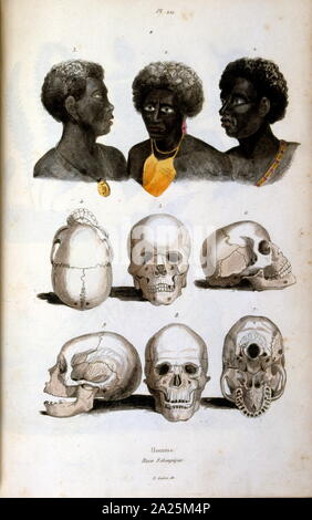 Anthropologische Abbildung: Darstellung der äthiopischen Rasse; durch F.E. Guérin. Von Wörterbuch pittoresque d'histoire naturelle et des phénomènes de la Nature - 1833/1834 Stockfoto