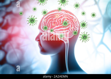Virus Infektion im Gehirn. Medizinischen Hintergrund. 3D-Darstellung Stockfoto