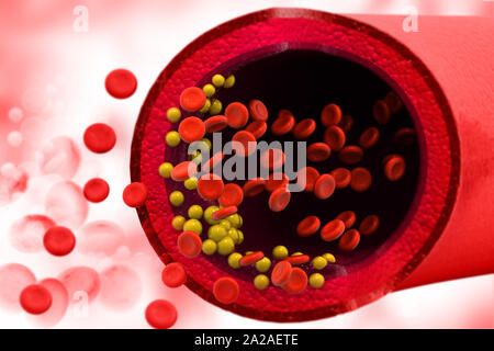 Cholesterin Plakette in den Blutgefäßen. Medizinischen Hintergrund. 3D-Darstellung Stockfoto