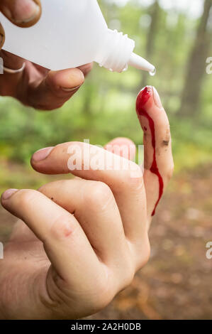 Finger mit eine blutende Wunde, mit einem Desinfektionsmittel aus der Flasche gewaschen ist, vor dem Hintergrund einer unscharfen Wald. Stockfoto