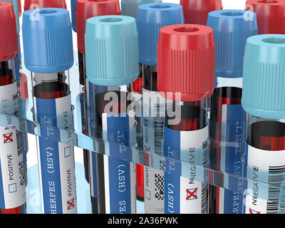 3D-Render von Blutproben mit Herpes Test im Rack auf weißem Hintergrund Stockfoto