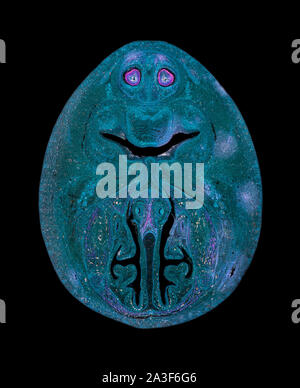 Olfaktorischer Bereich gefärbter Abschnitt, Katze, Dunkelfeld-Photomikrograph. Stockfoto